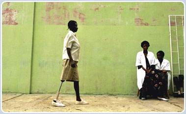 Amputee, Angola